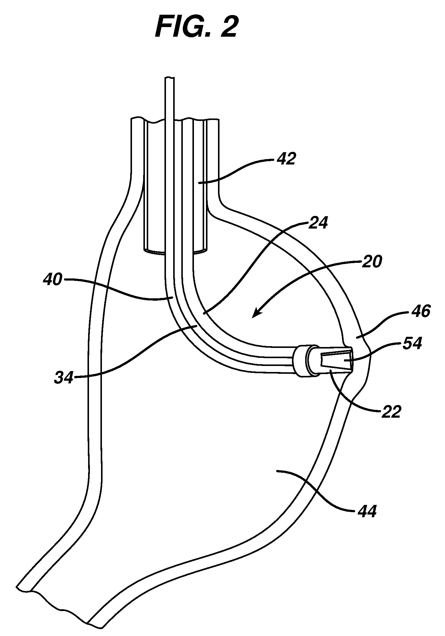 Method for plicating and fastening gastric tissue