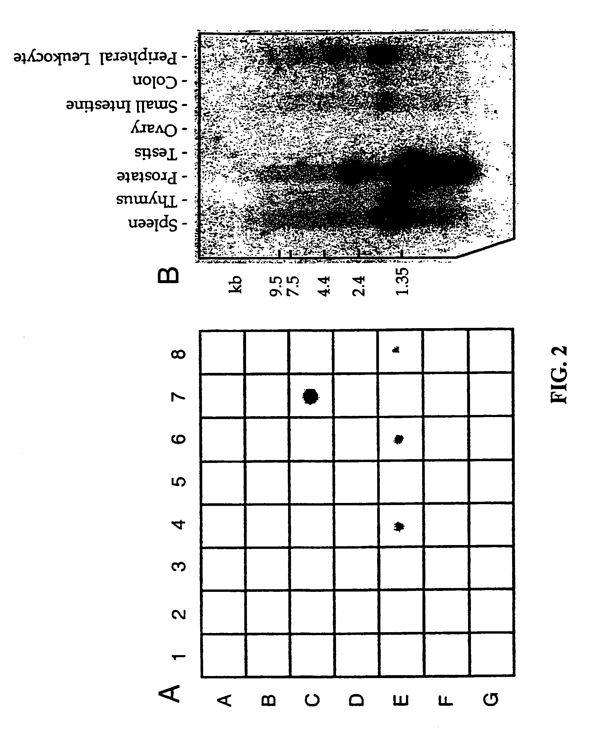 T-cell receptorγ alternate reading frame protein, (TARP) and uses thereof
