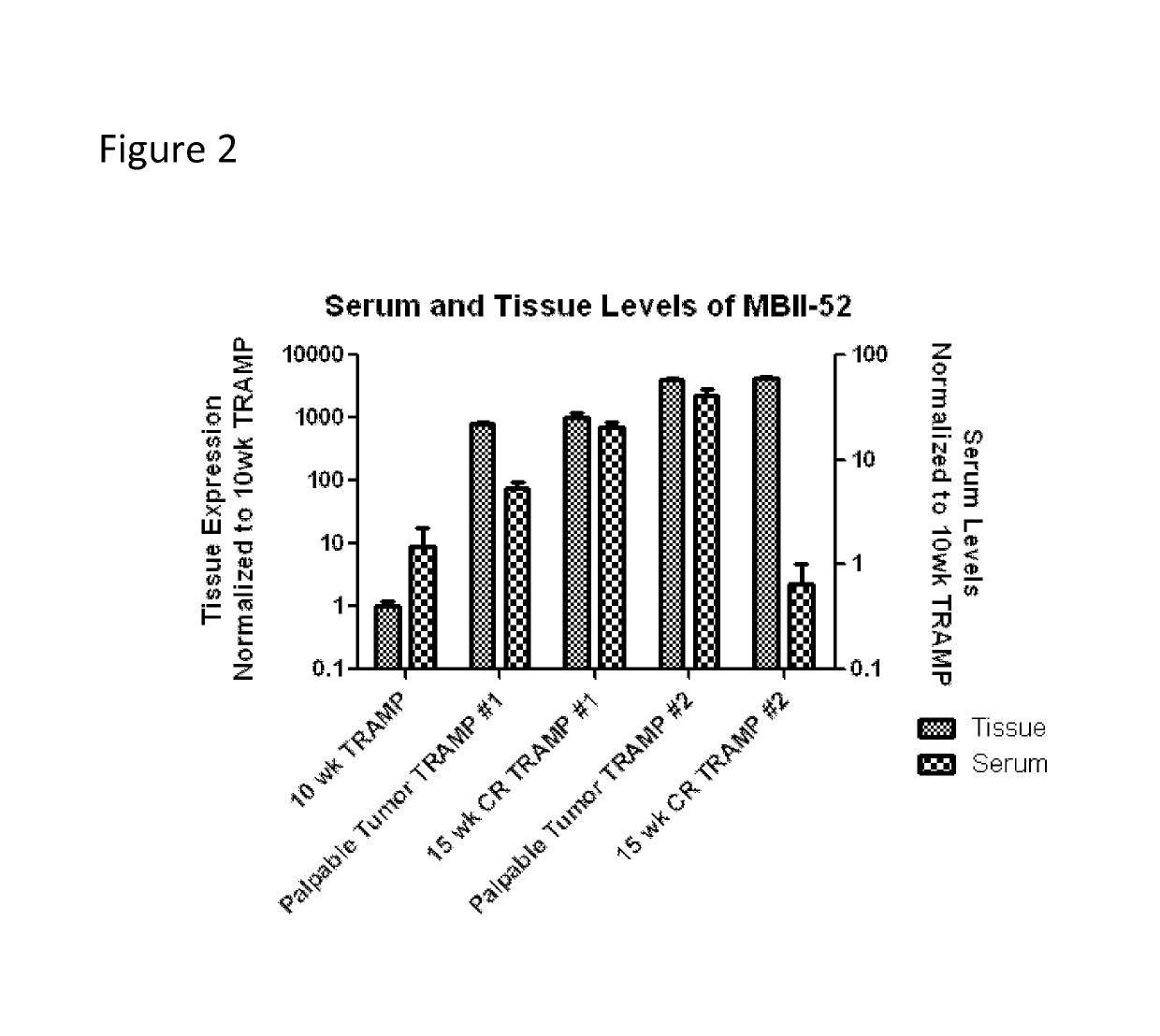 Methods for diagnosing cancer based on small nucleolar RNA HBII-52