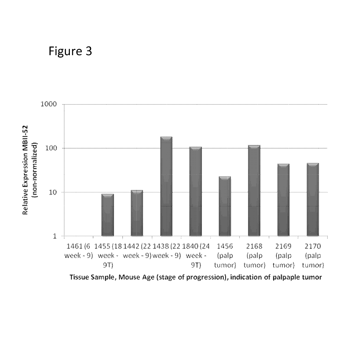 Methods for diagnosing cancer based on small nucleolar RNA HBII-52