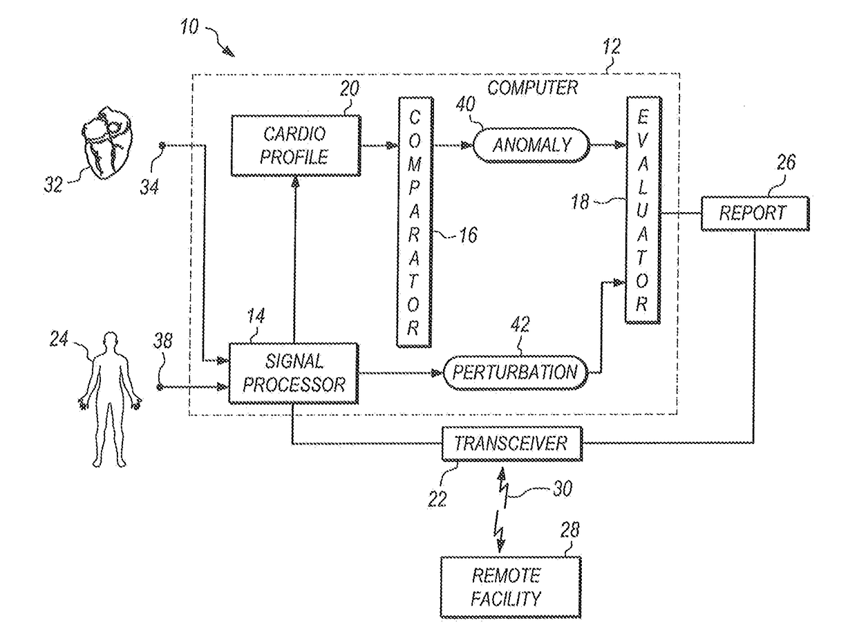 System for monitoring and evaluating cardiac anomalies