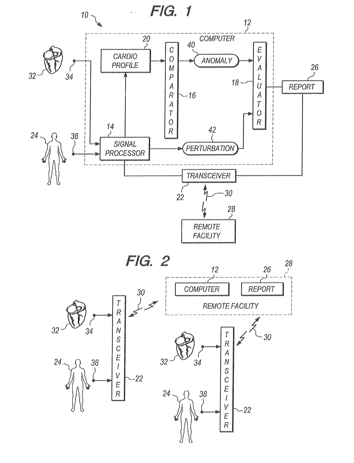 System for monitoring and evaluating cardiac anomalies