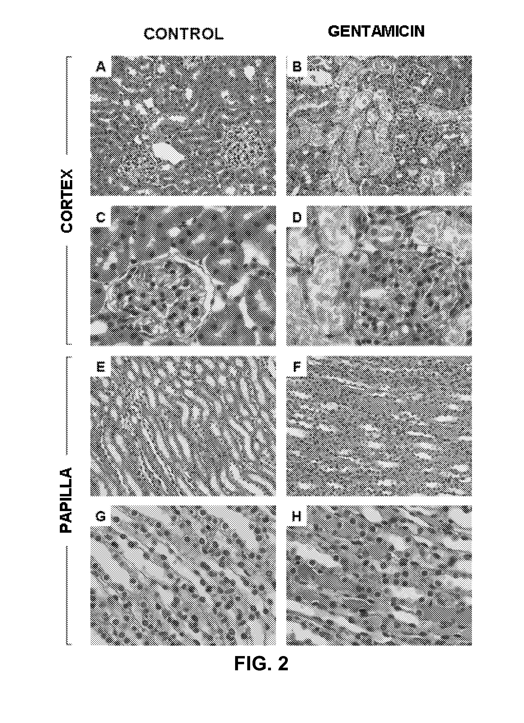 Method for the detection of renal damage