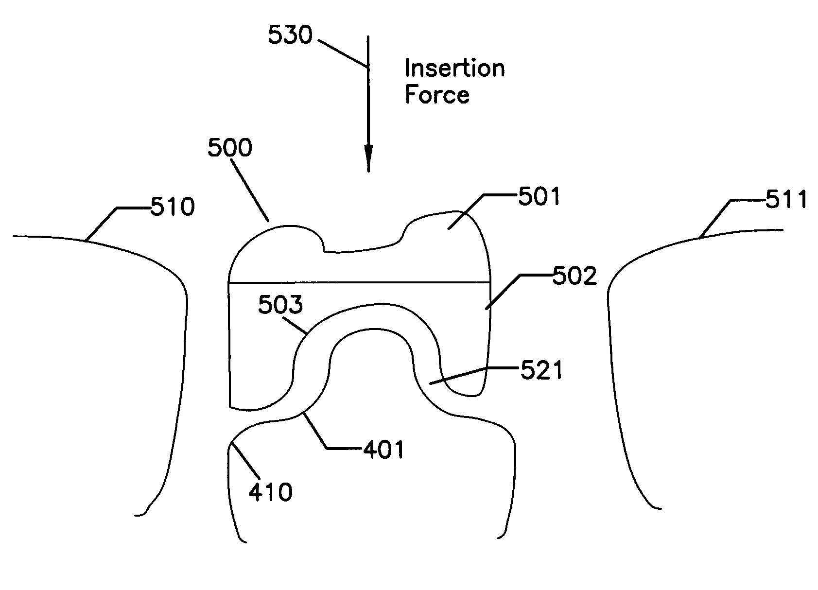 Method and apparatus for constructing crowns, bridges and implants for dental use