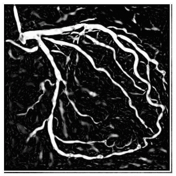 A kind of image fusion method and system of CT coronary image and xa angiography image