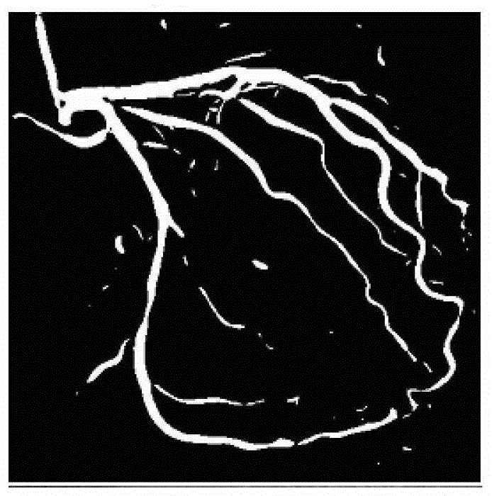 A kind of image fusion method and system of CT coronary image and xa angiography image