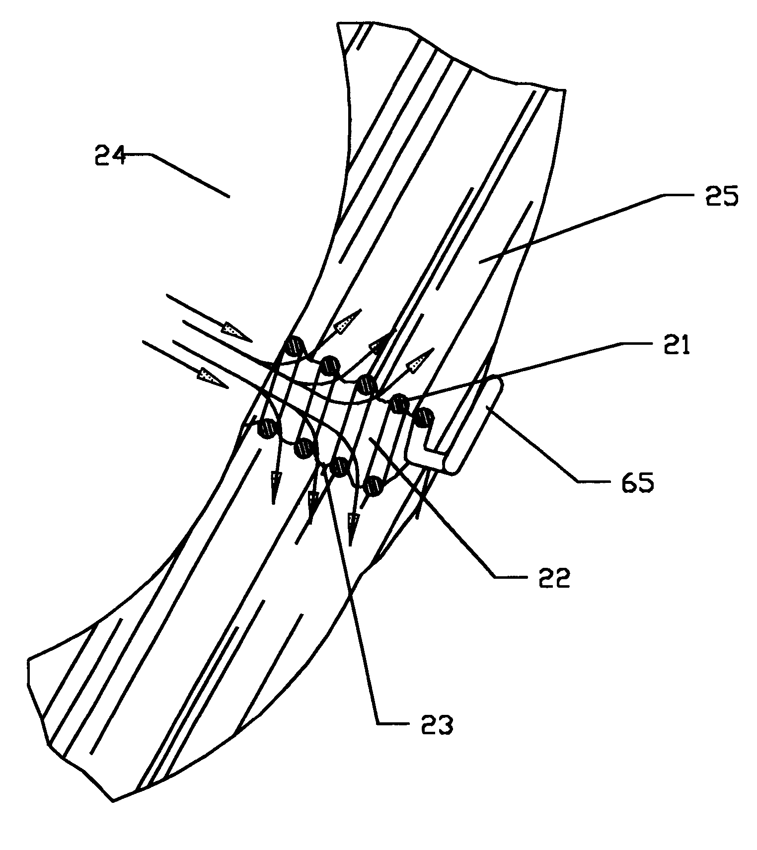 Implant device for trans myocardial revascularization