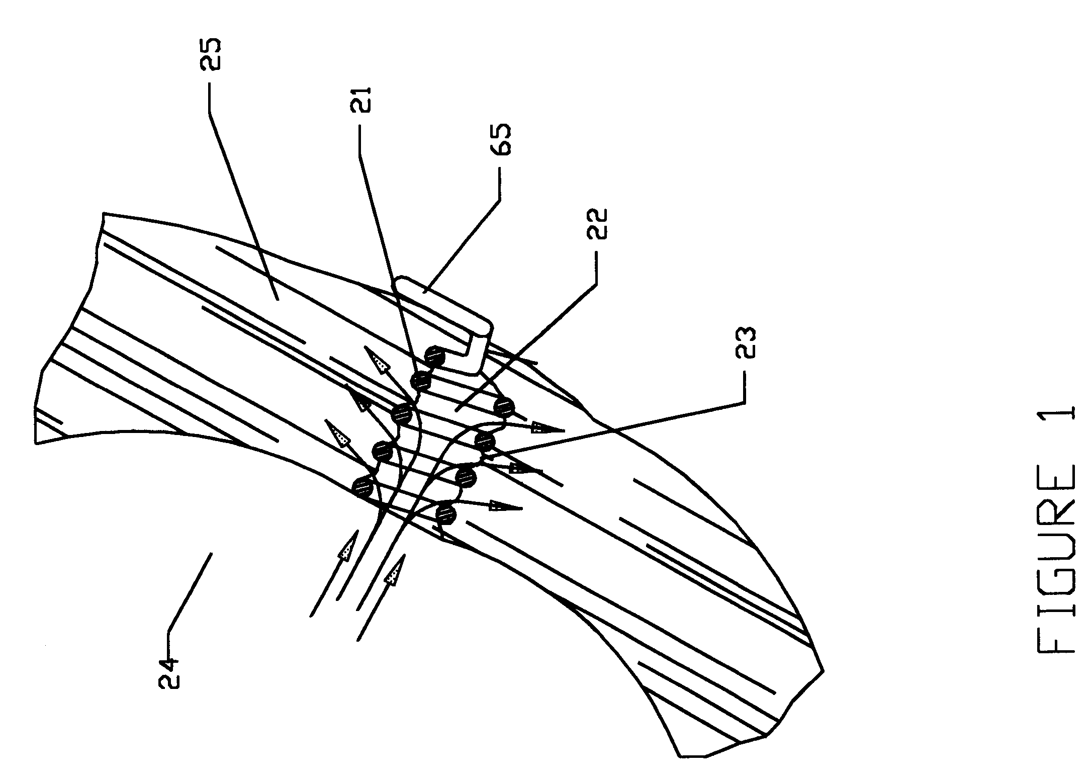 Implant device for trans myocardial revascularization