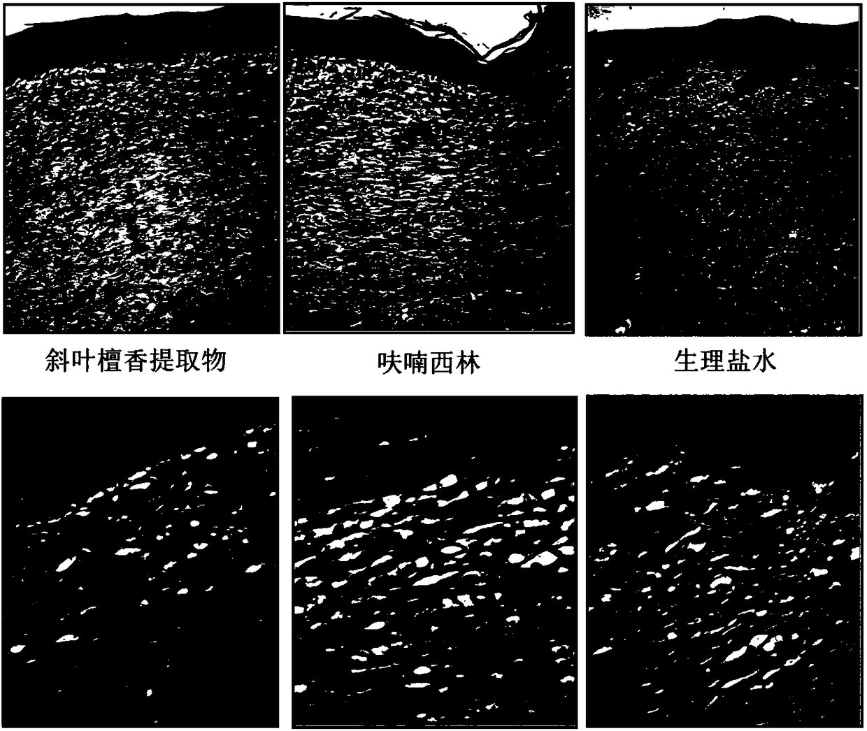 Application of extract of dalbergia pinnata in preparing drug for healing skin wound