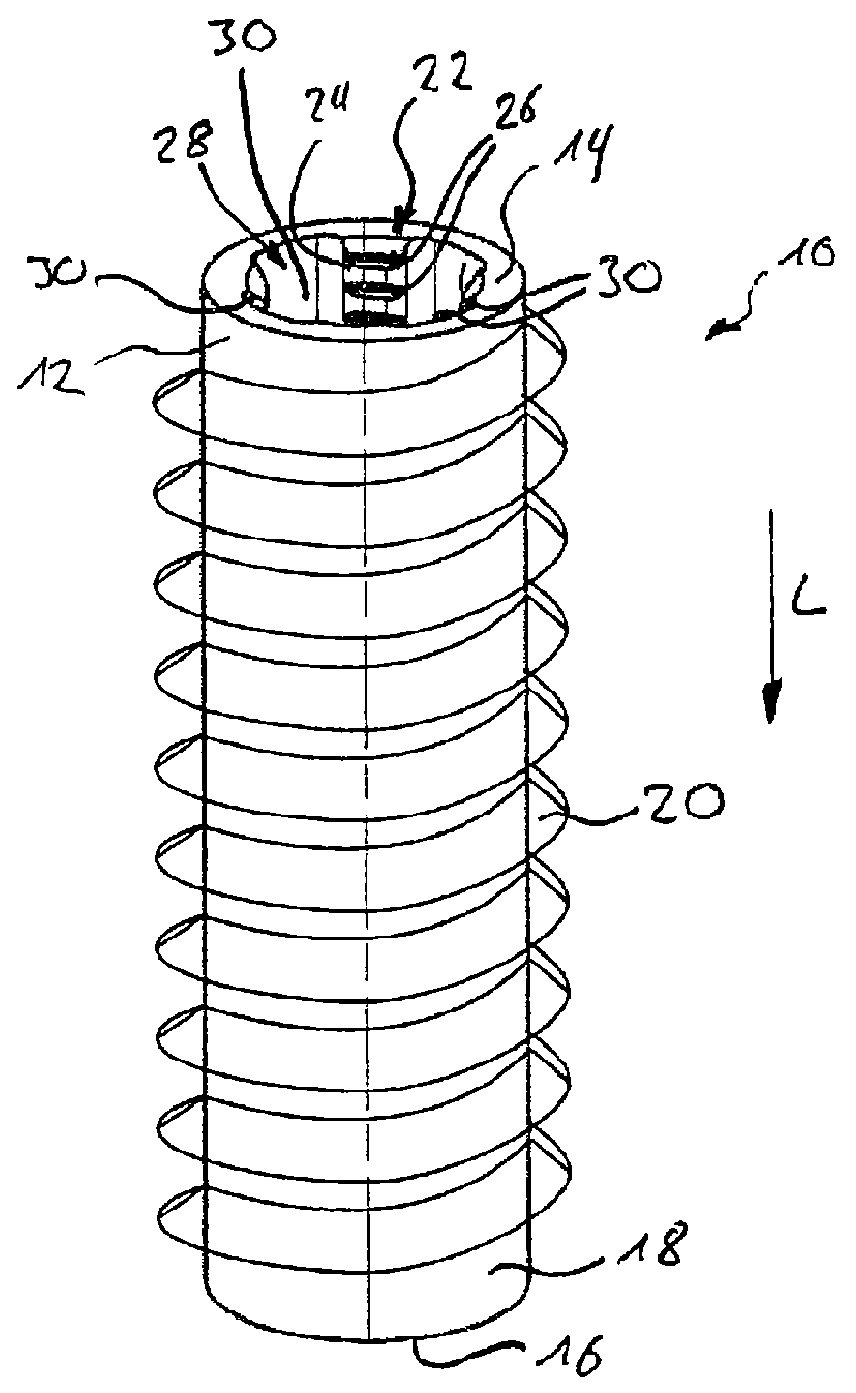 Screw anchor and method for producing a screw anchor