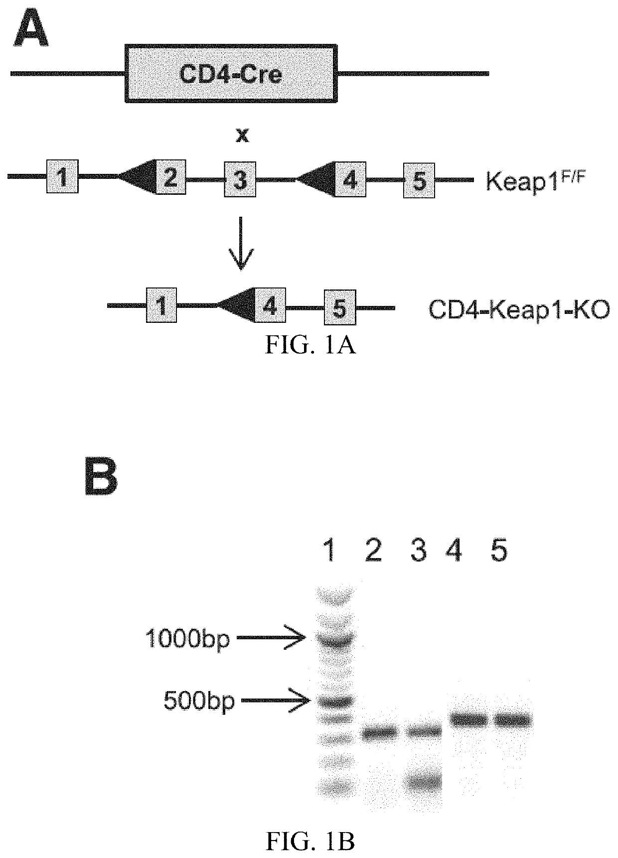 Compositions and methods for the study and treatment of acute kidney injury