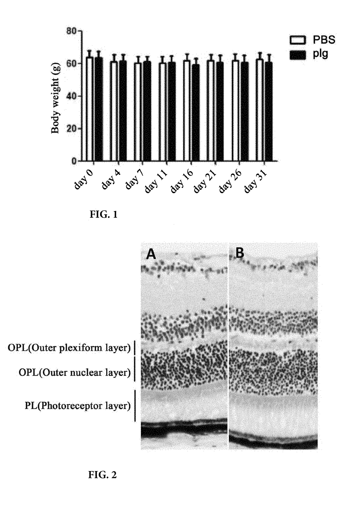 Method for preventing or treating diabetic retinopathy