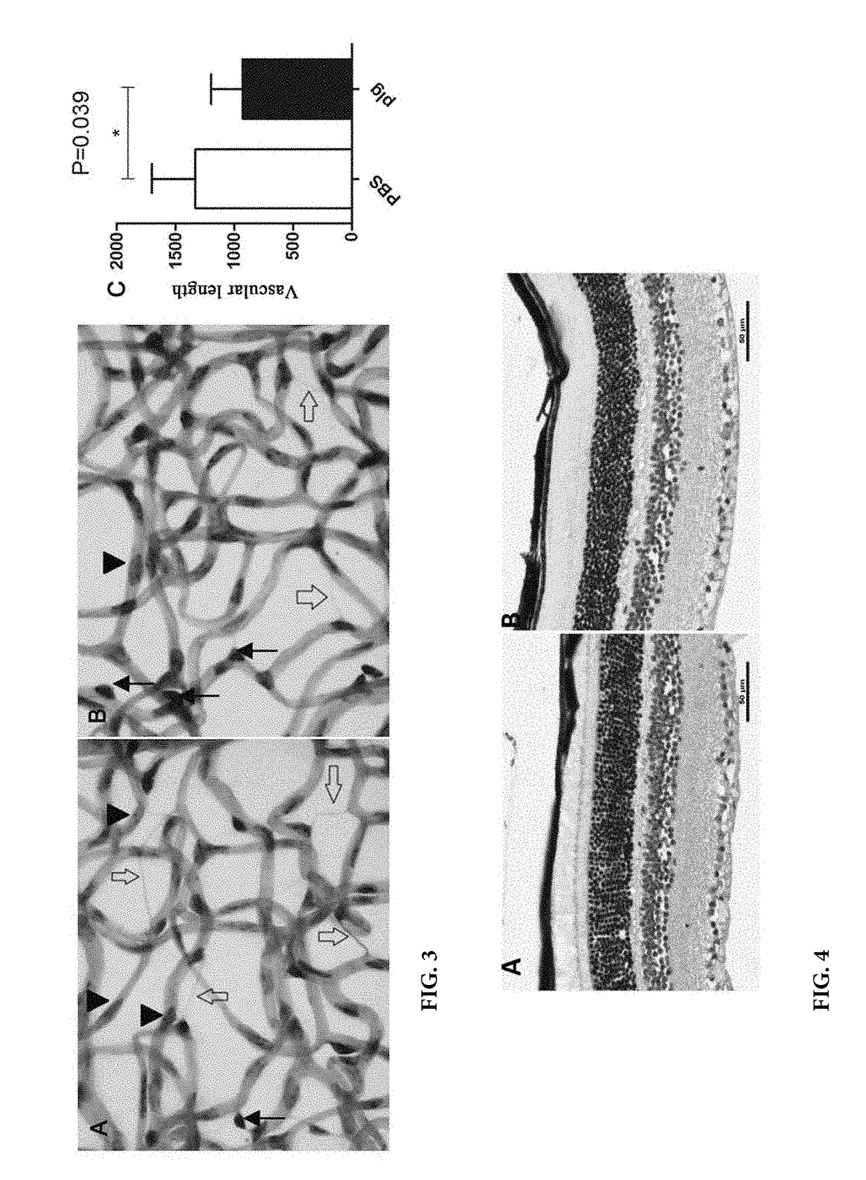 Method for preventing or treating diabetic retinopathy