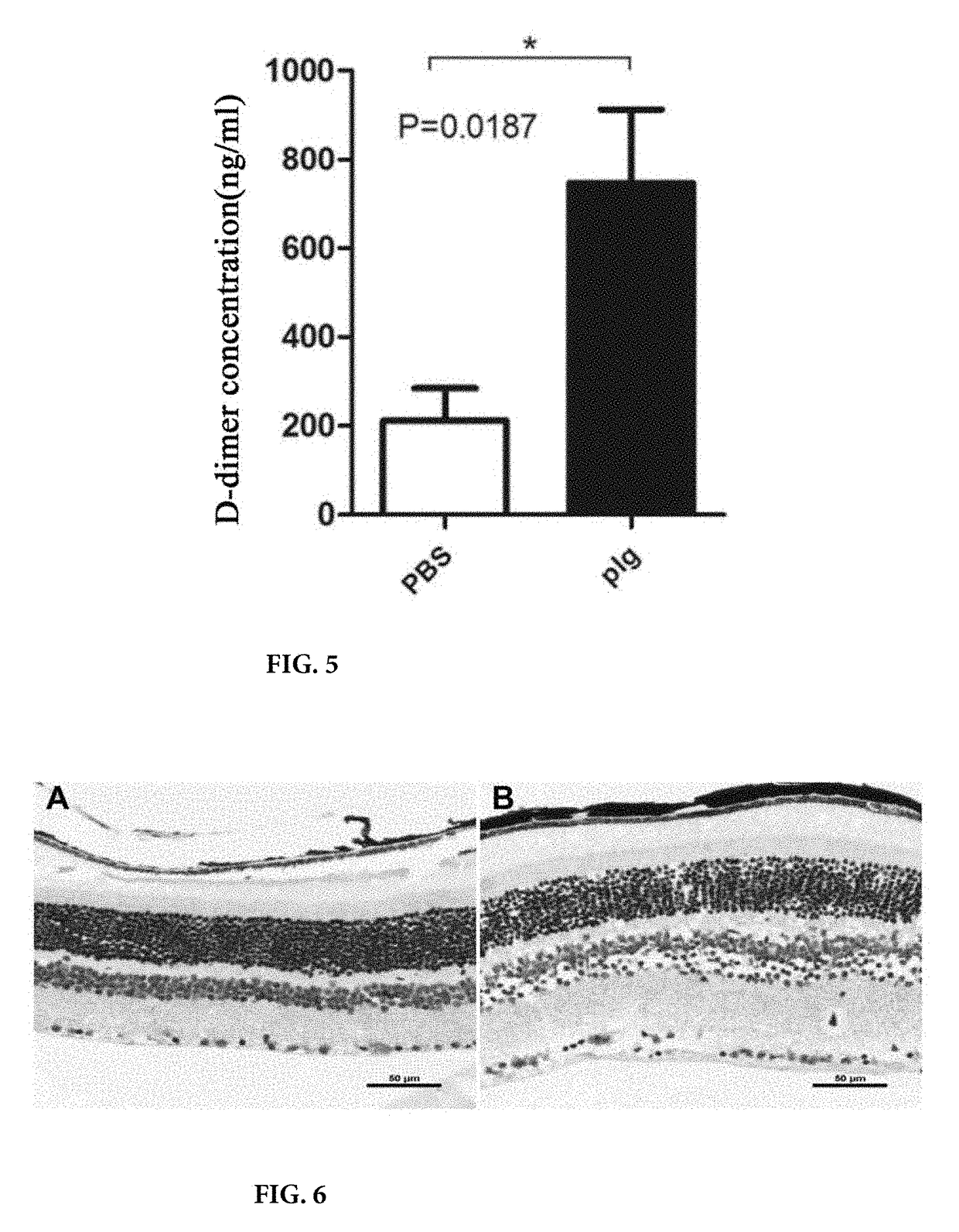 Method for preventing or treating diabetic retinopathy