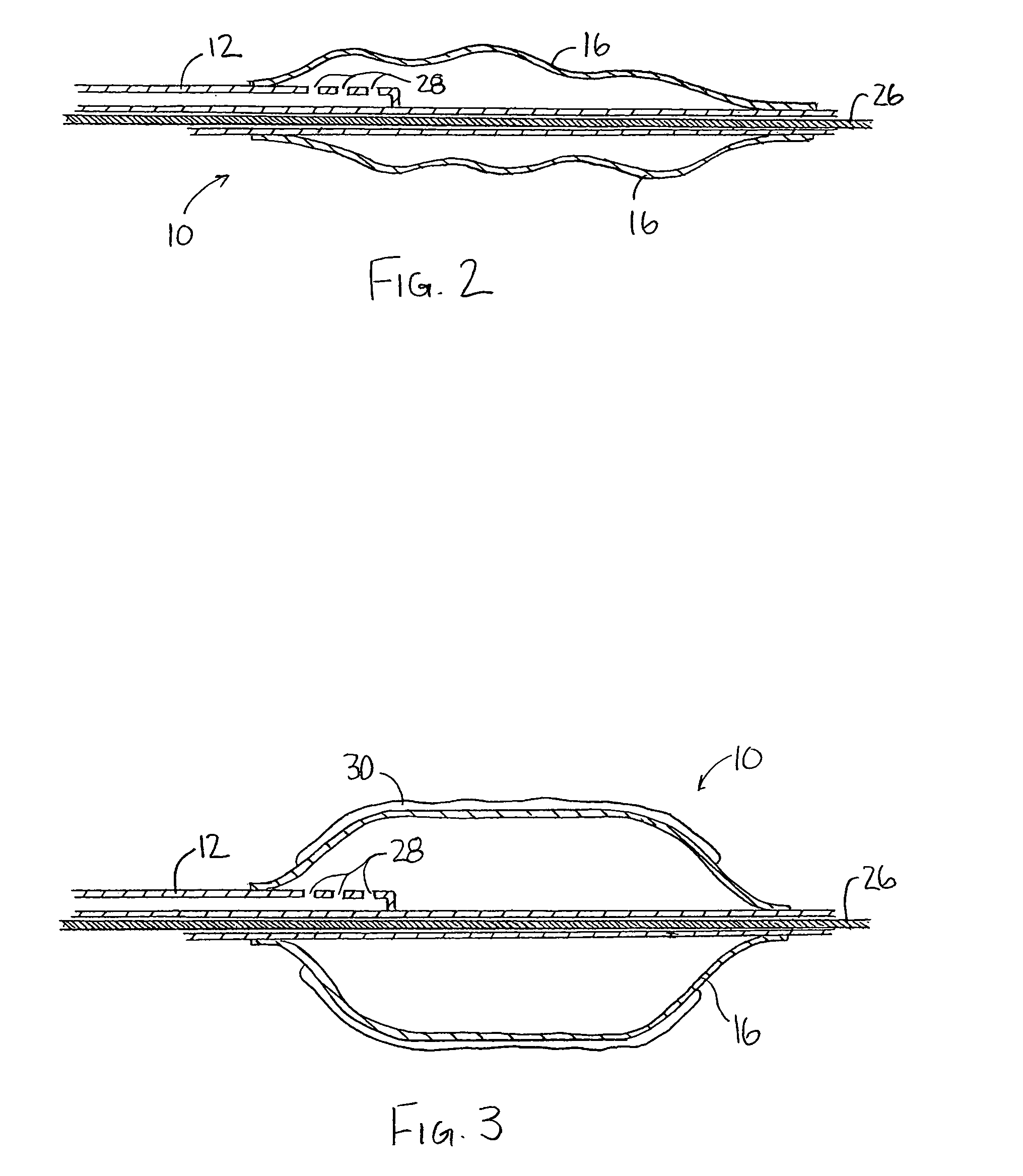 Application of a therapeutic substance to a tissue location using an expandable medical device