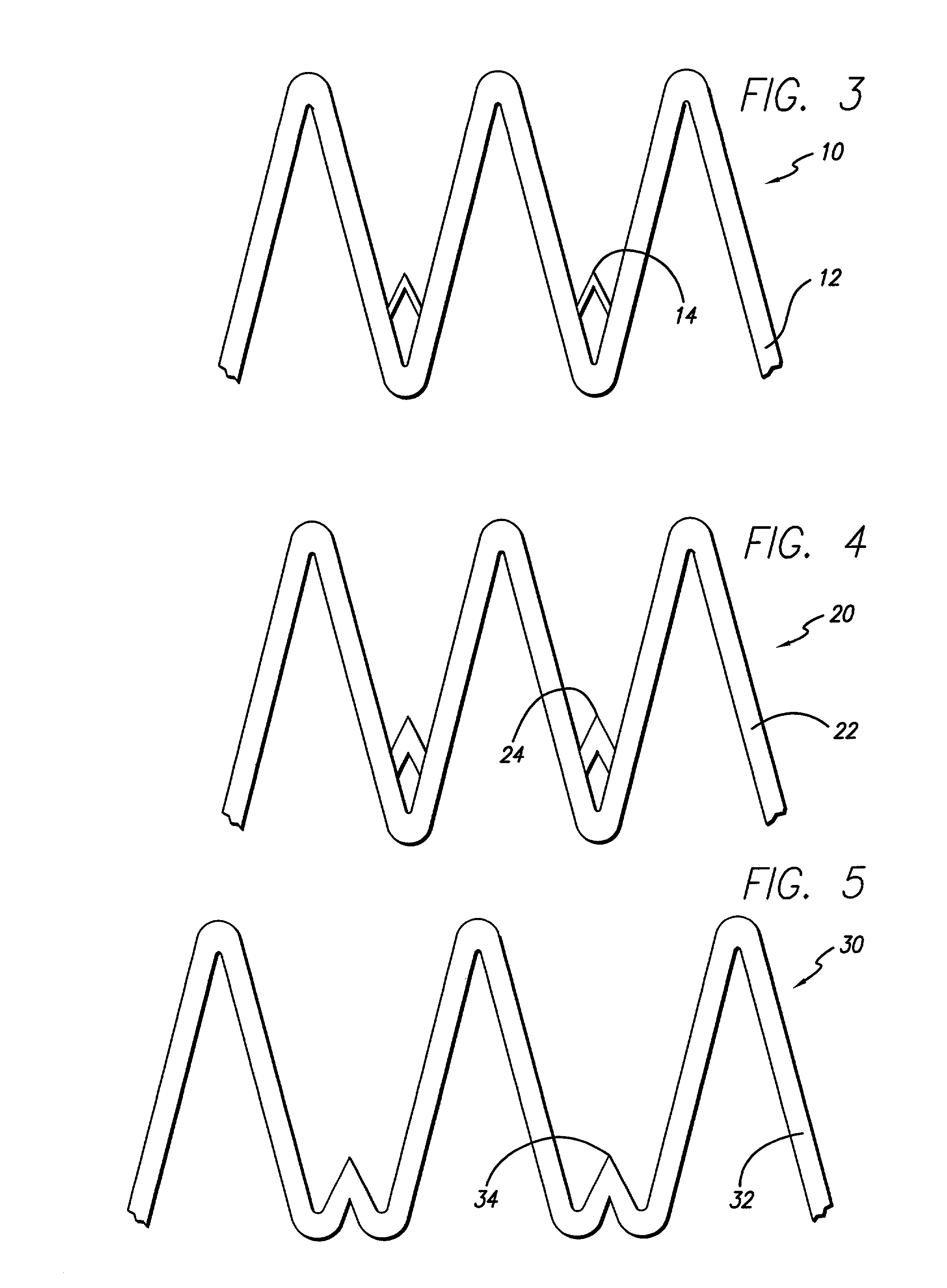 Anchoring device for an endoluminal prosthesis