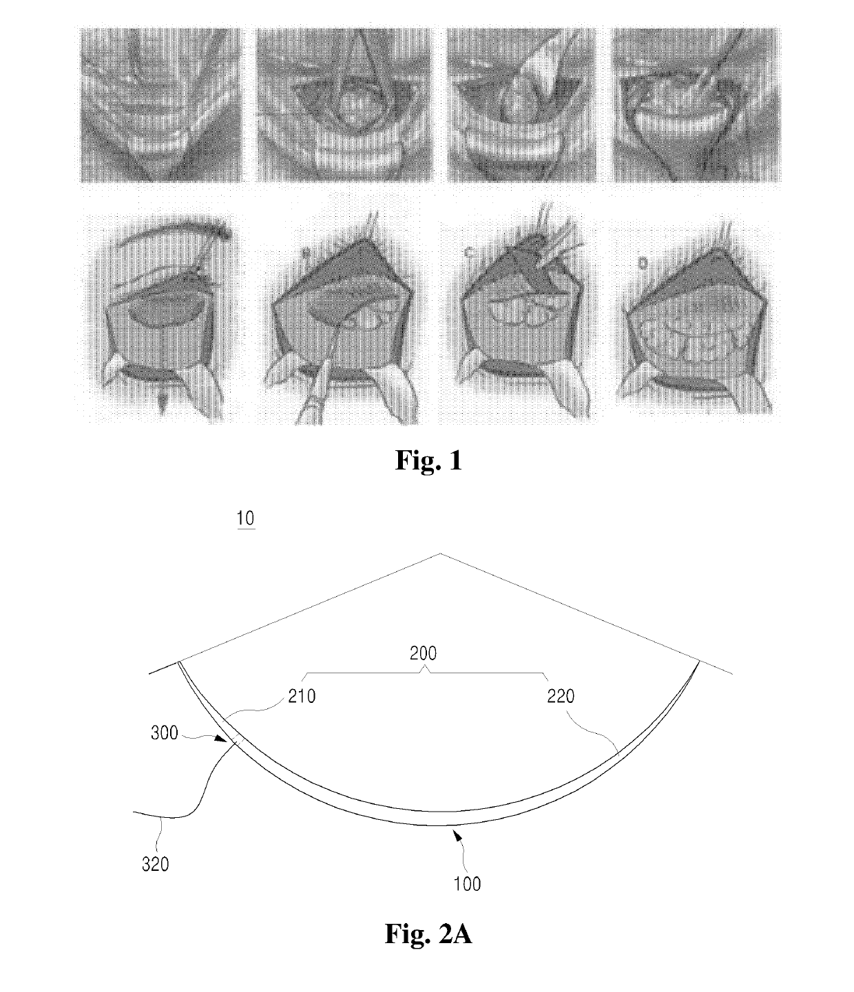 Needle instrument for eye-bag relocating operation