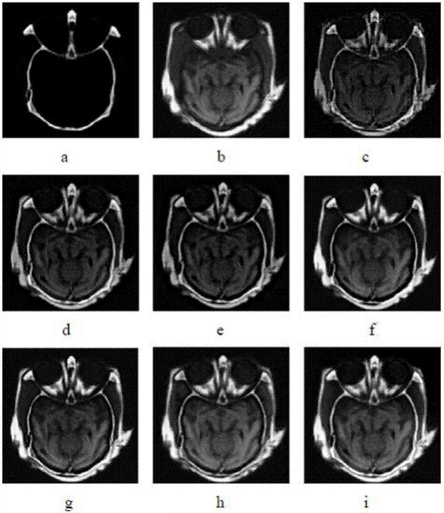Brain CT/MR (Computed Tomography/ Magnetic Resonance) image fusion method for improved coupled dictionary learning on the basis of sparse representation