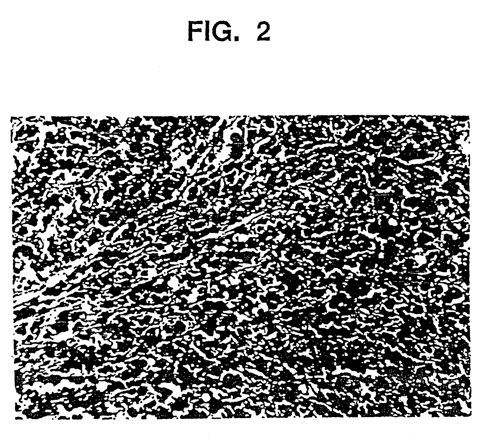 Tissue augmentation material and method