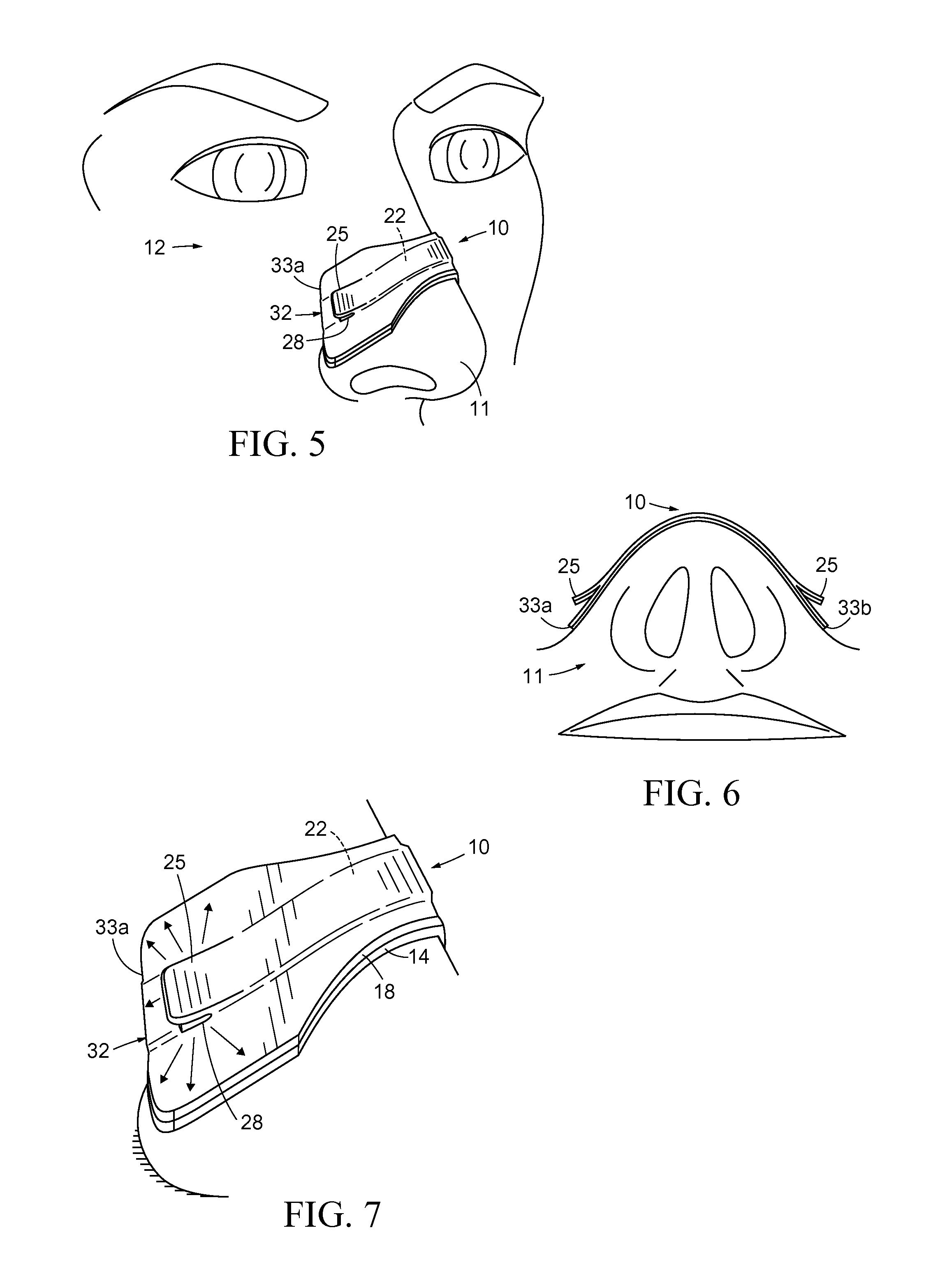 Nasal Dilator with Means to Direct Resilient Properties