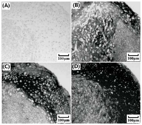 Mesenchymal stem cell induced differentiation and coating culture dish preparation