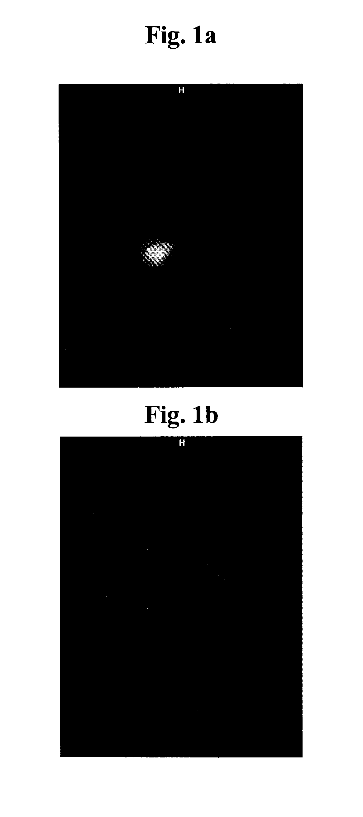 Composition of a first non-labeled monoclonal antibody binding to a tumor antigen and a non-cross reactive second monoclonal antibody labeled with a NIR fluorescence label