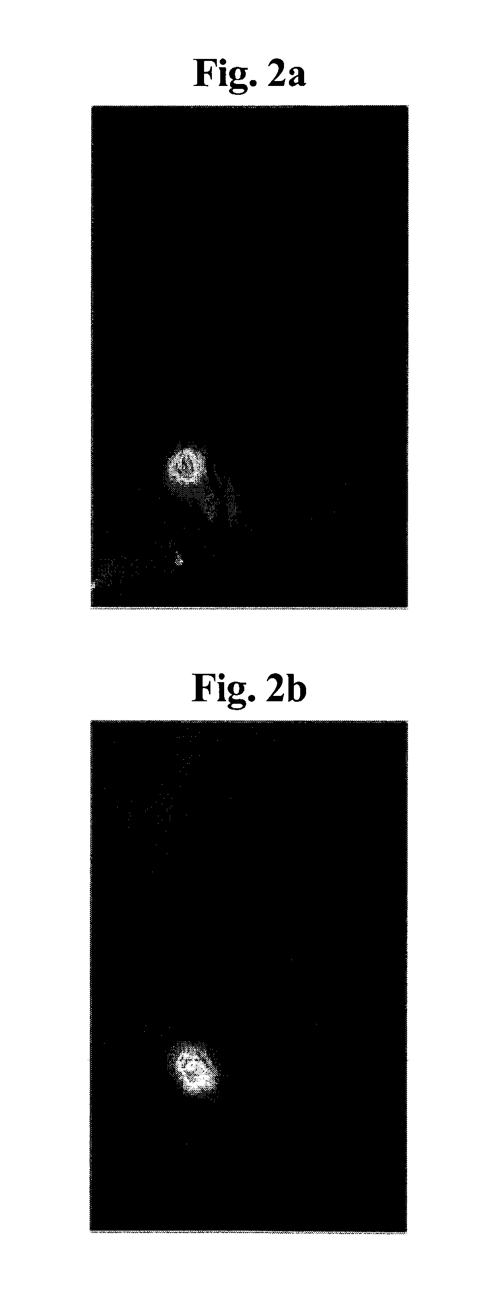 Composition of a first non-labeled monoclonal antibody binding to a tumor antigen and a non-cross reactive second monoclonal antibody labeled with a NIR fluorescence label