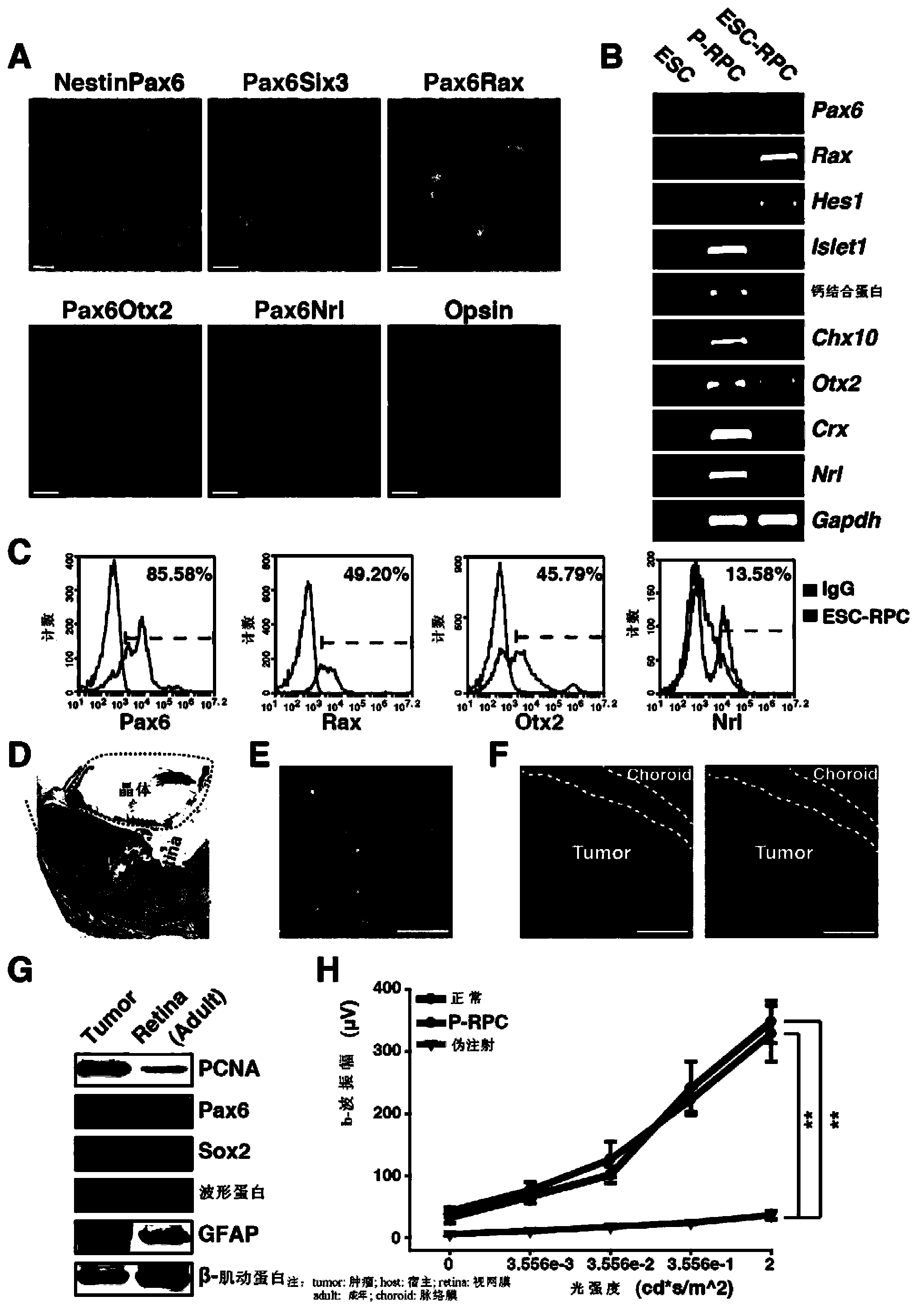 Method of regulating and controlling retinal progenitor cell generated by inducing
