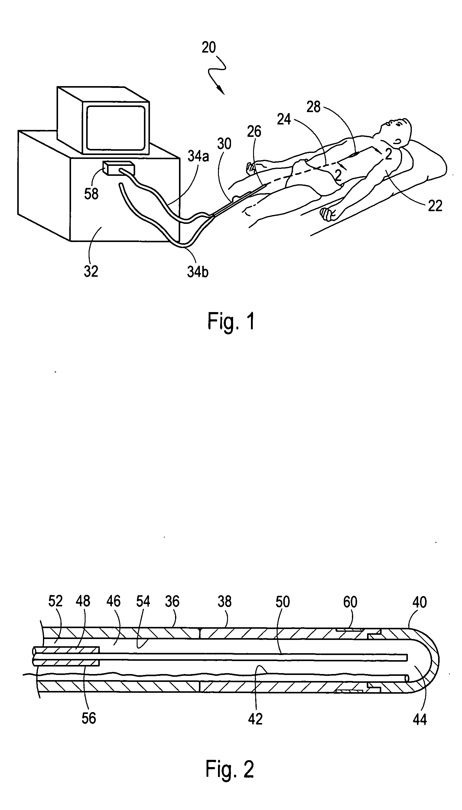 Warming gradient control for a cryoablation applicator