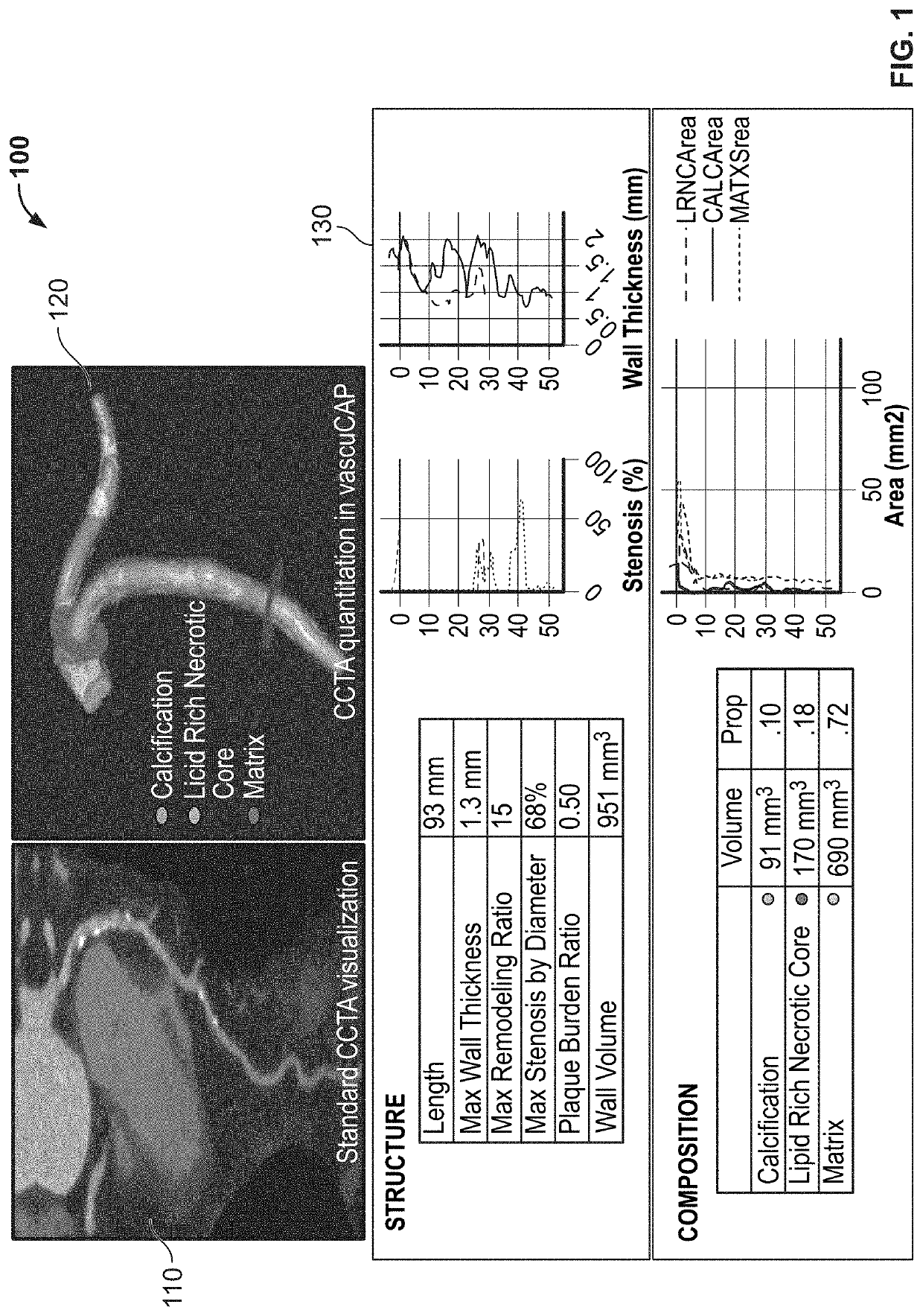 Systems and methods for improving soft tissue contrast, multiscale modeling and spectral ct