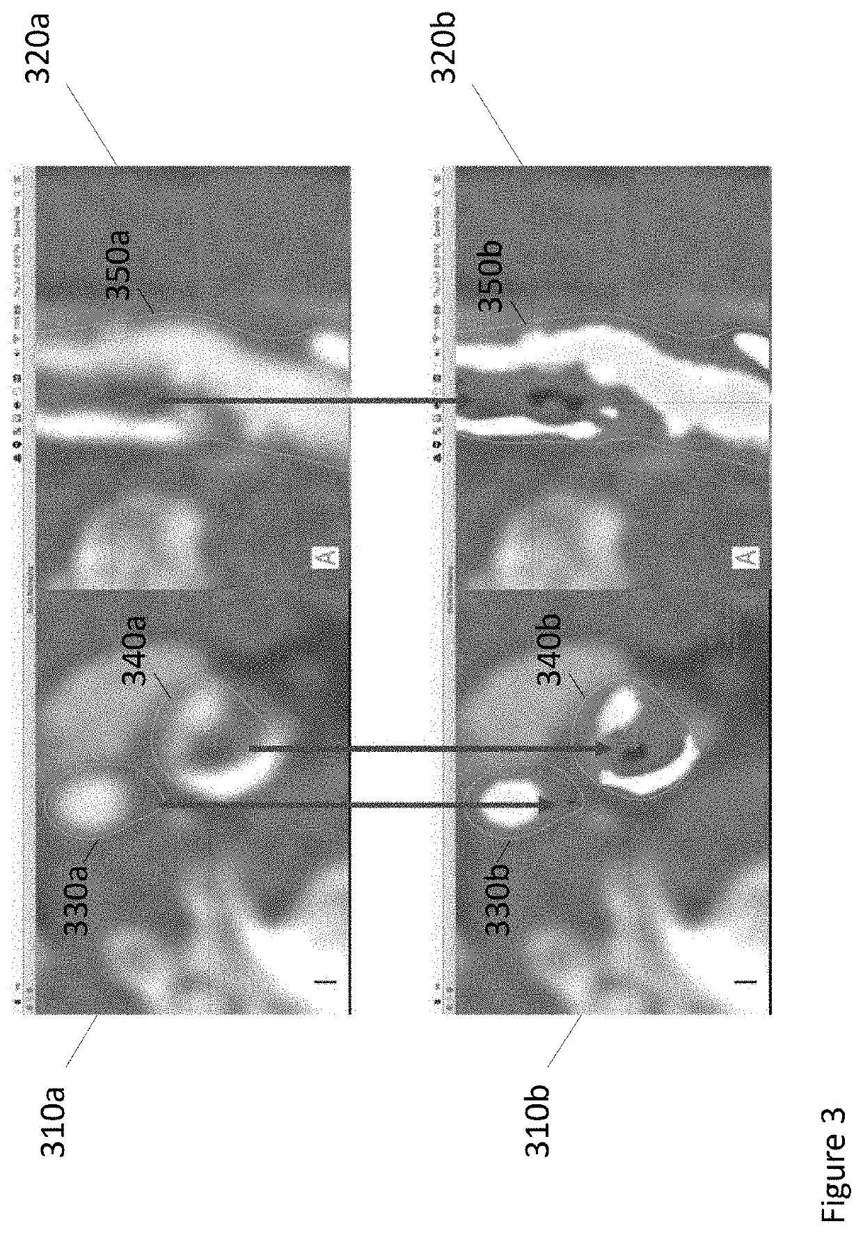 Systems and methods for improving soft tissue contrast, multiscale modeling and spectral ct