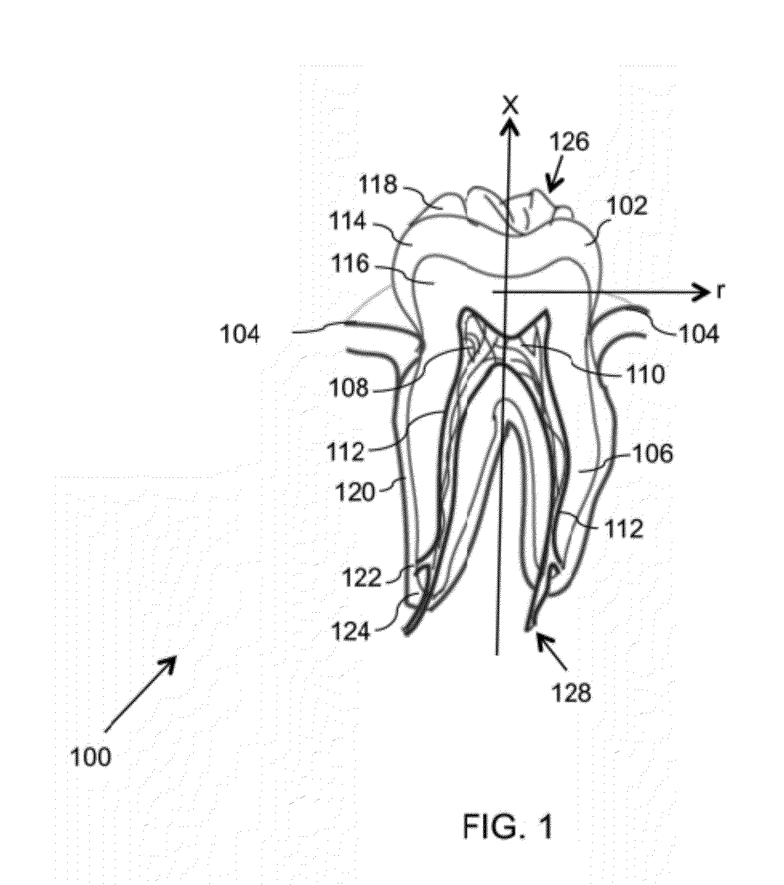 Devices and methods for intraoral controlled drug release