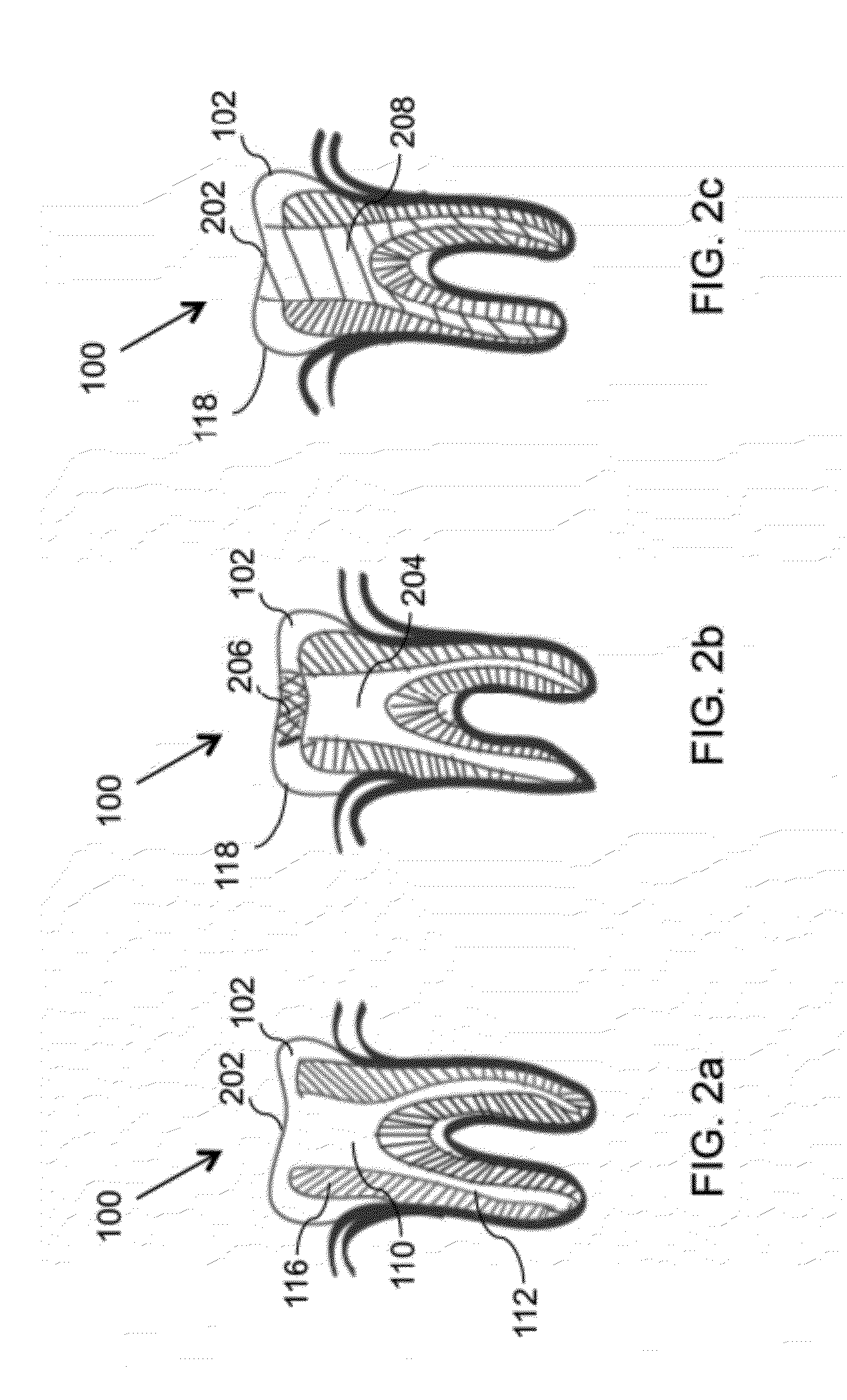 Devices and methods for intraoral controlled drug release