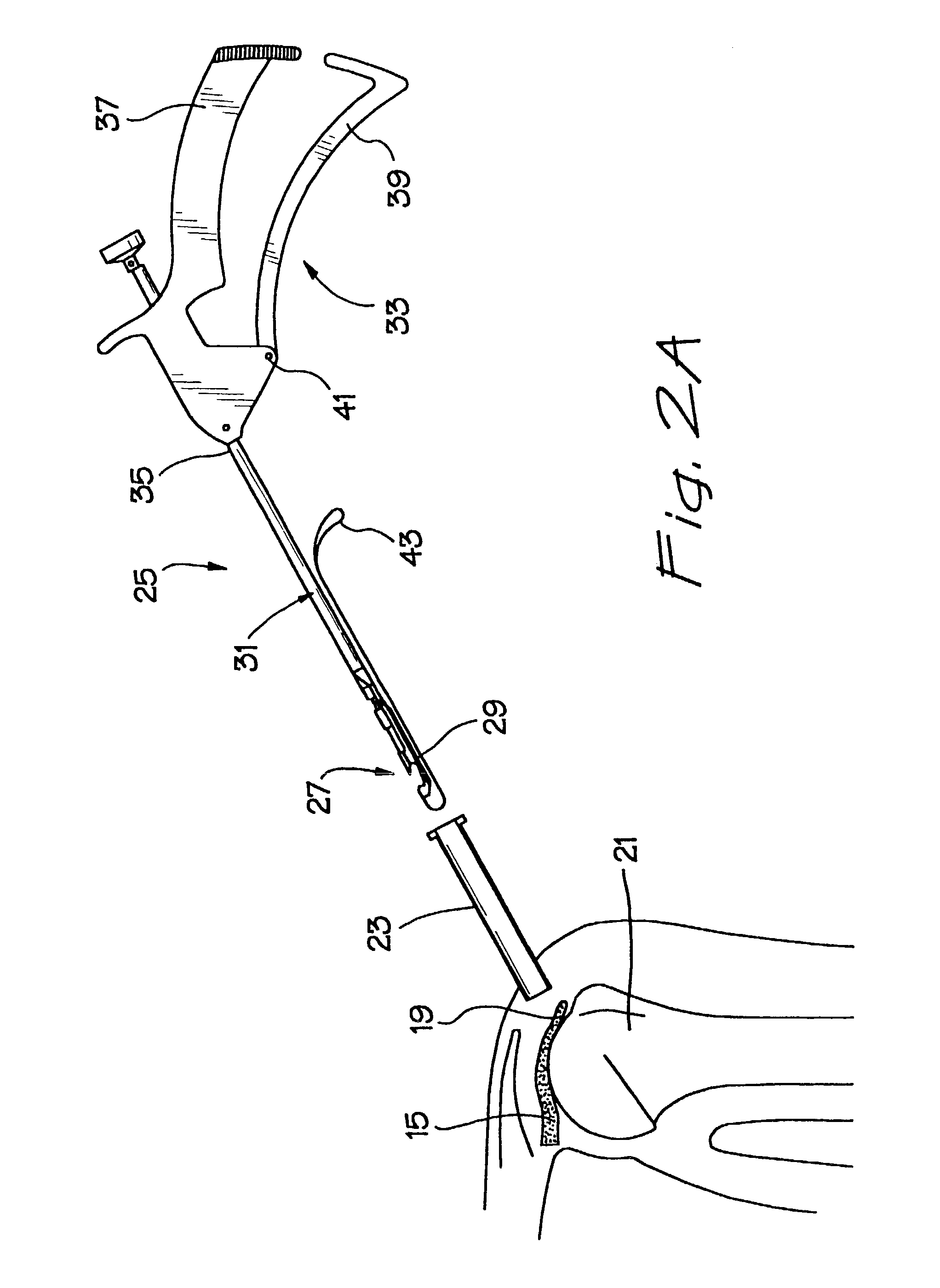 Linear suturing apparatus and methods