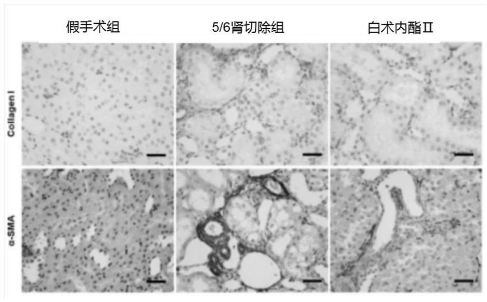 Application of atractylenolide II in preparation of anti-renal fibrosis drug and anti-renal fibrosis drug