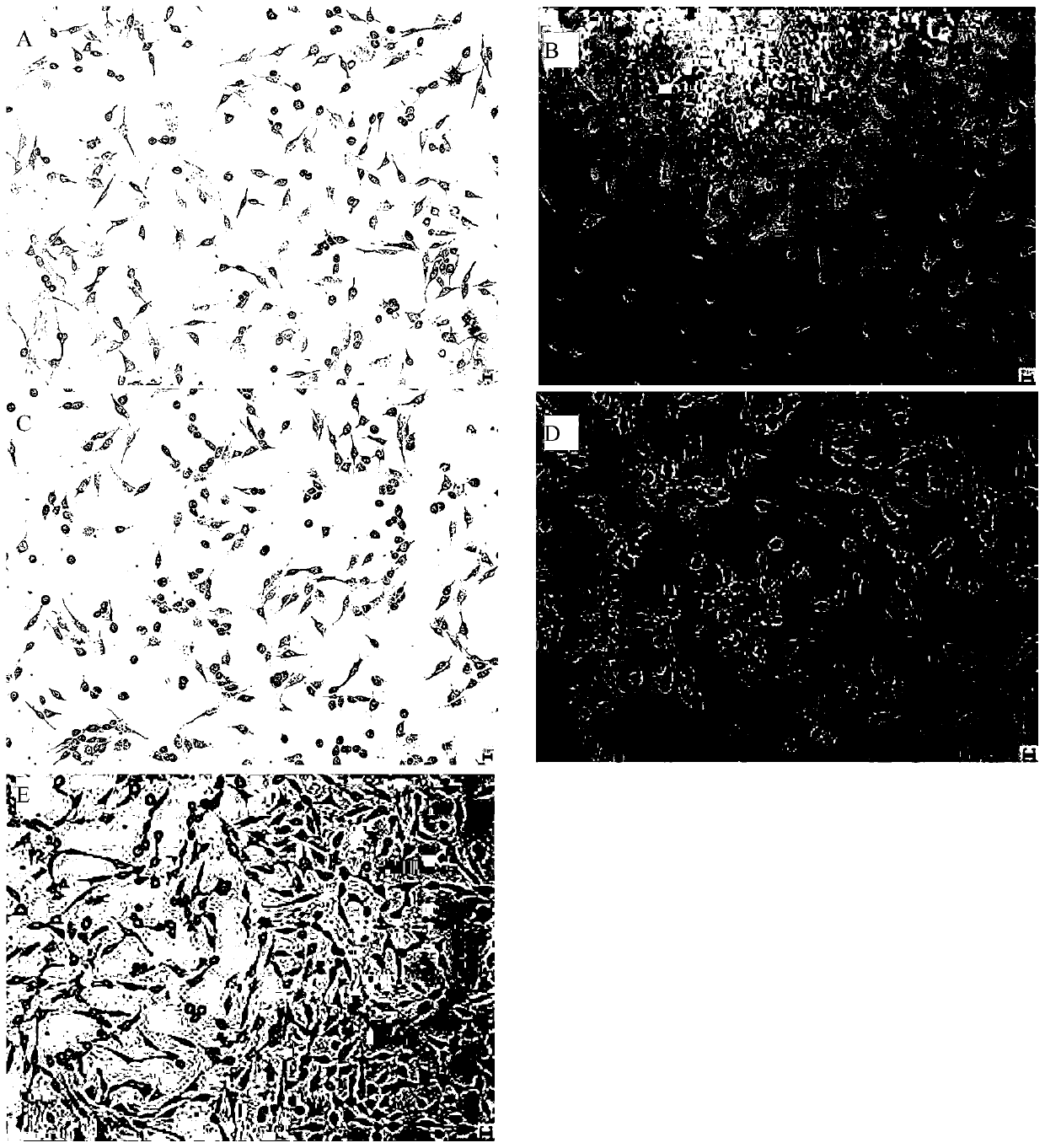 Neem-lily extract for preventing and treating Propionibacterium acnes and its application