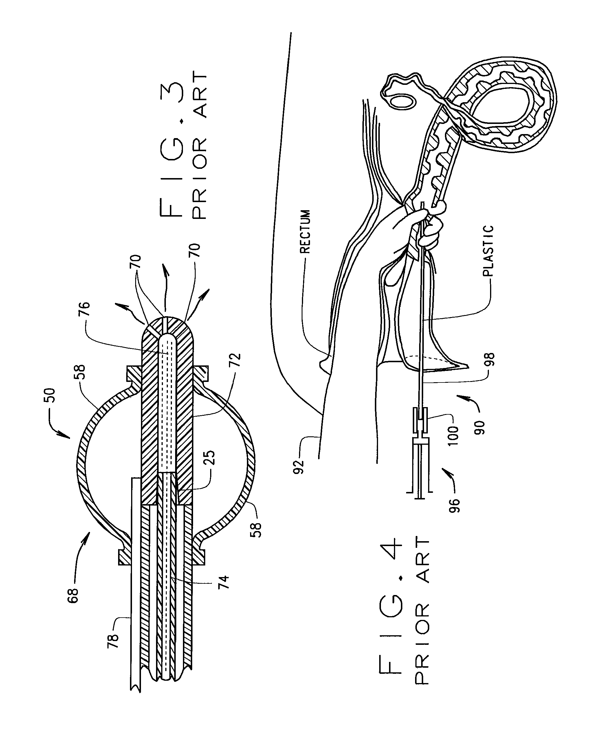 Method and apparatus to reduce the number of sperm used in artificial insemination of cattle