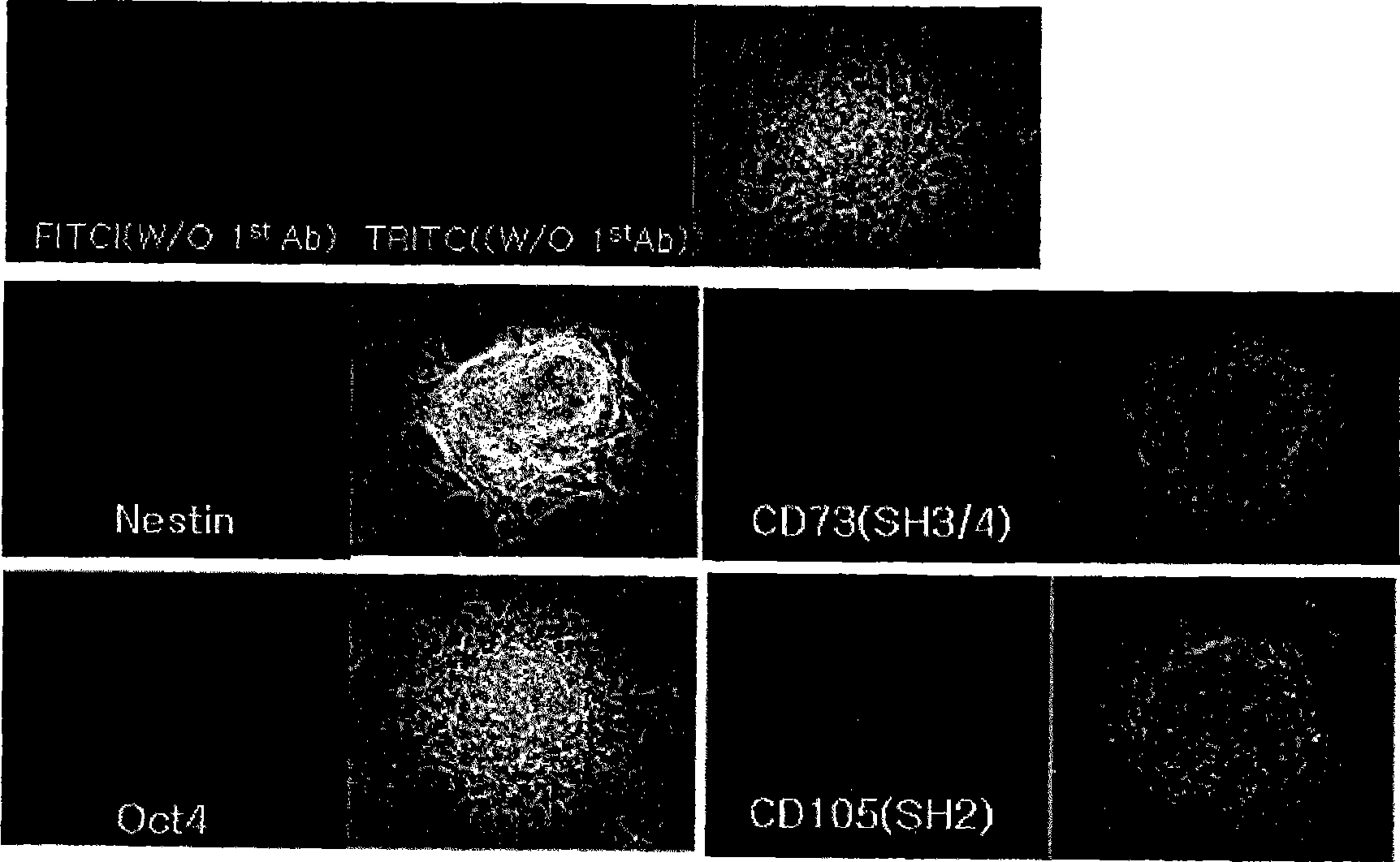 Cosmetic or plastic composition comprising multipotent stem cells derived from human adipose tissue, fibroblast, and adipose or adiopocyte