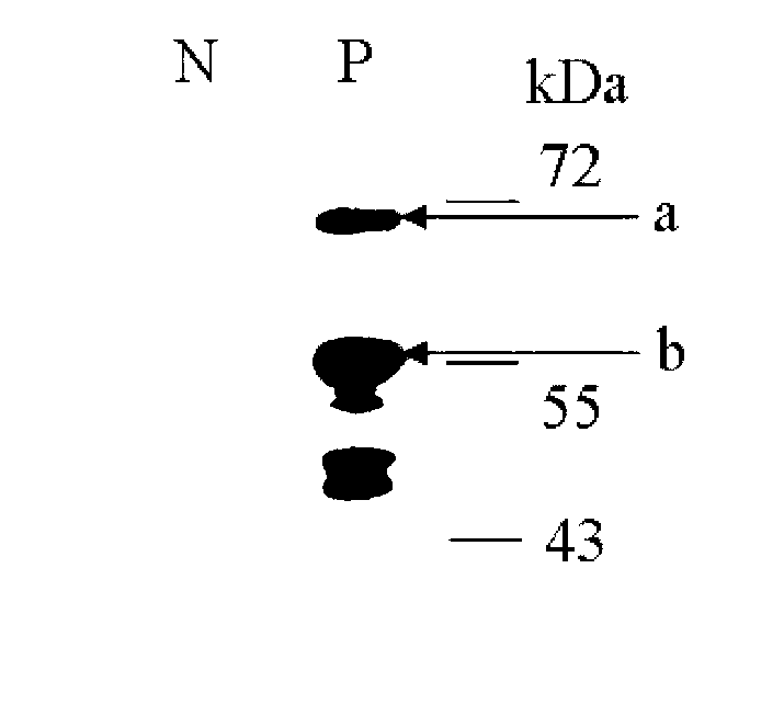 Sendai virus antigen peptide composition and application thereof in detecting Sendai virus infection