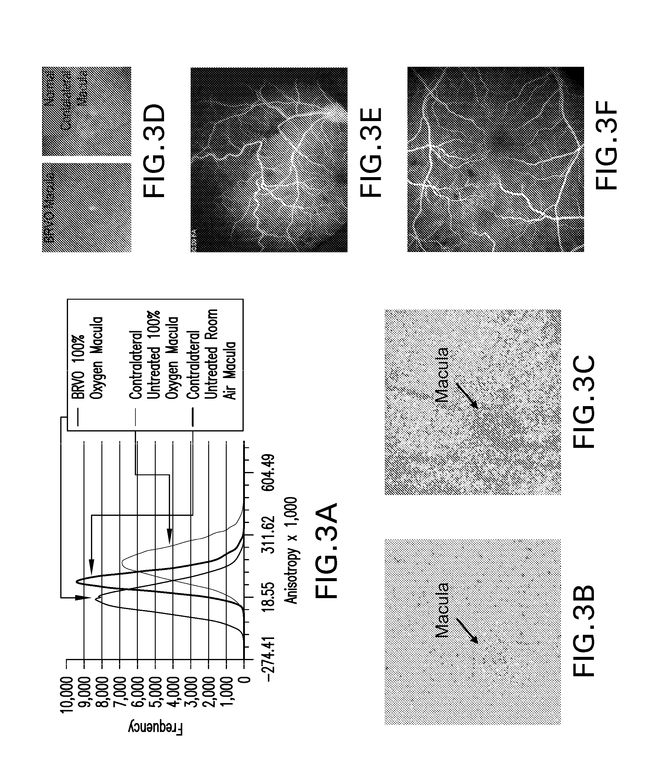 Method and apparatus for the non-invasive measurement of tissue function and metabolism by determination of steady-state fluorescence anisotropy