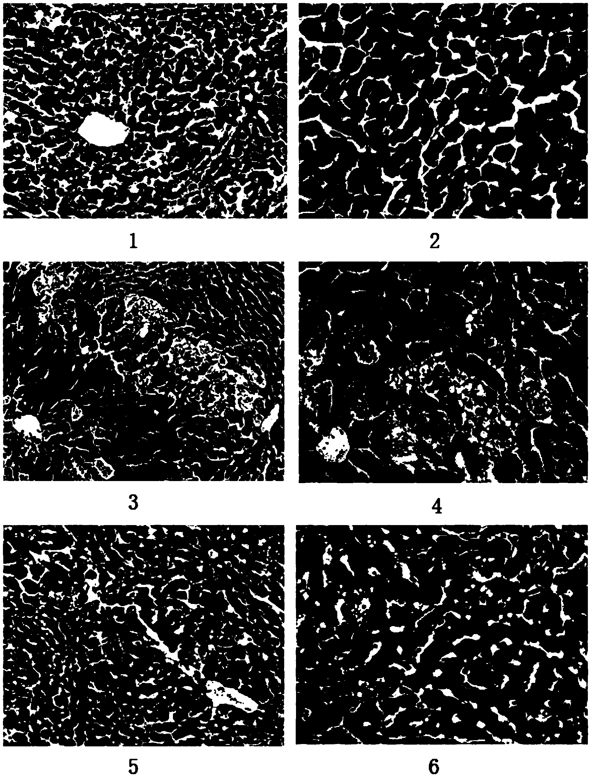 Ring-A polyoxidizing substituted glycyrrhetinic acid derivative and preparation method and application thereof