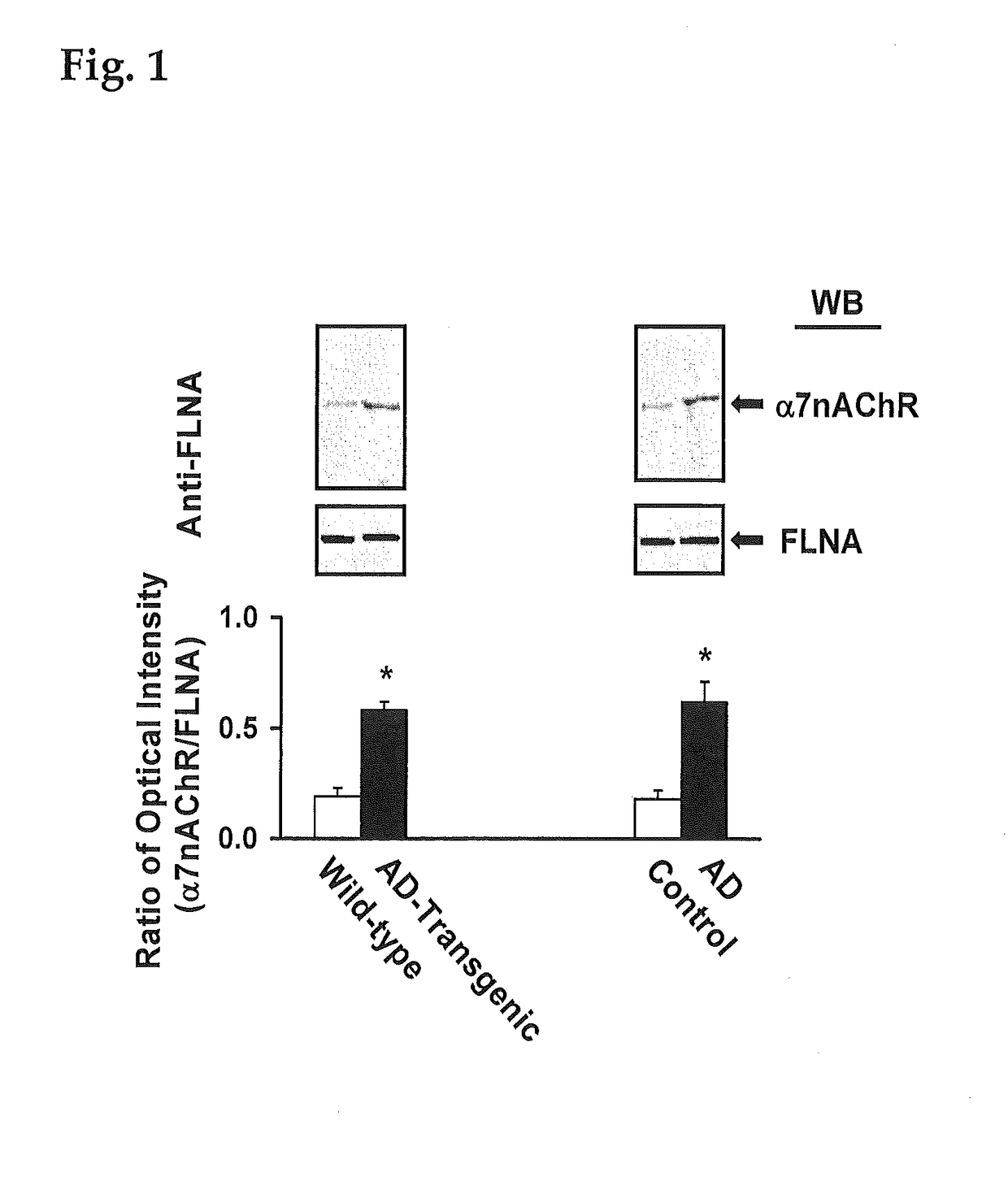 Method of inhibiting tau phosphorylation