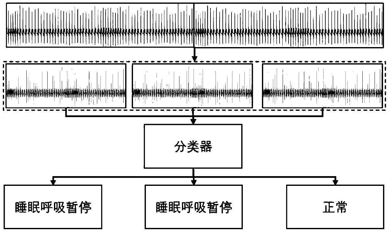 Time sequence physiological data classification method and device, storage medium and processor