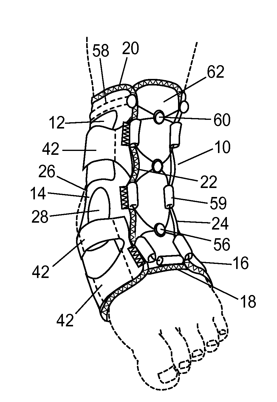 Ankle support with splint and method of using same