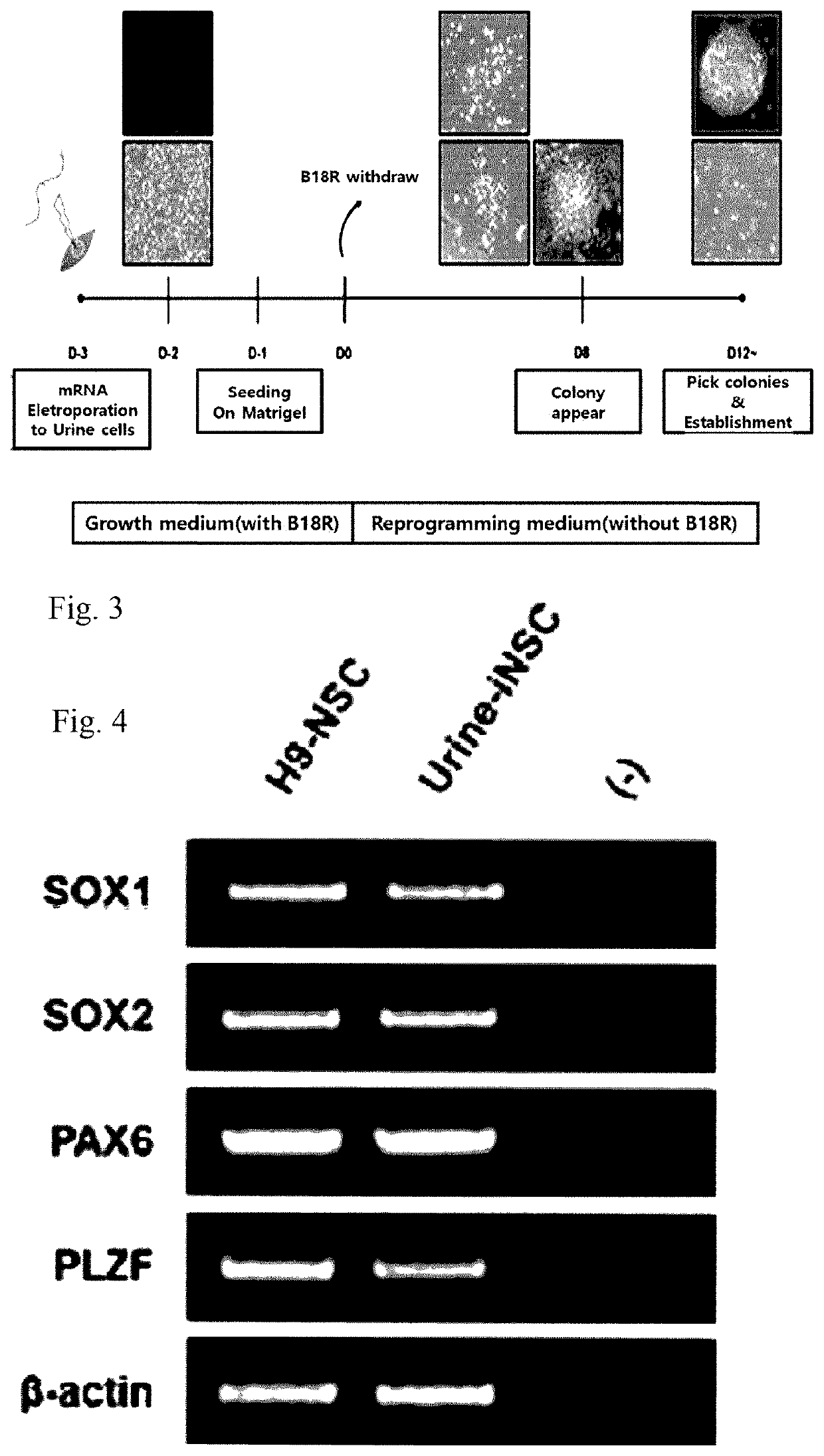 A method for direct reprogramming of urine cells into neural stem cells using synthetic mRNA