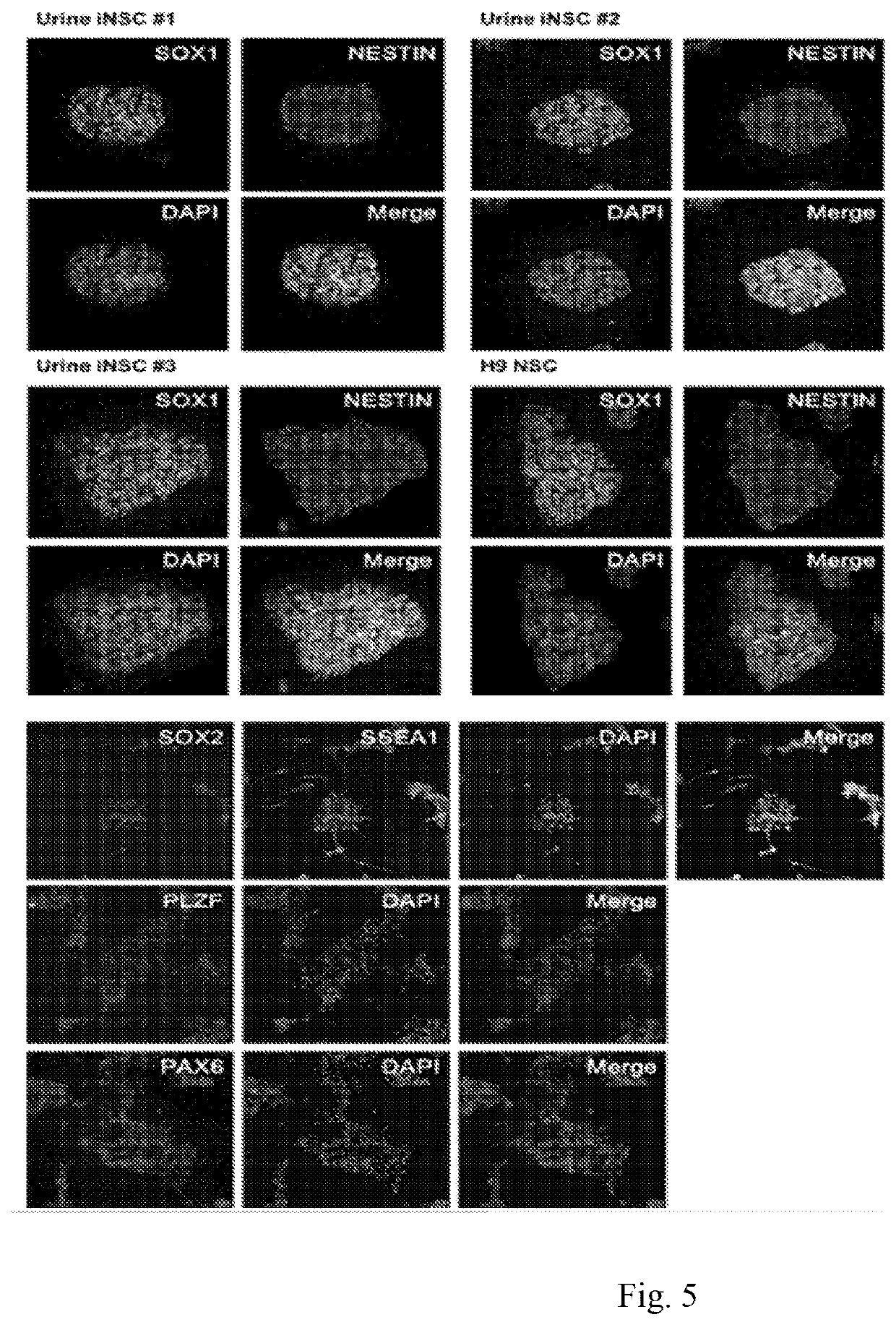 A method for direct reprogramming of urine cells into neural stem cells using synthetic mRNA