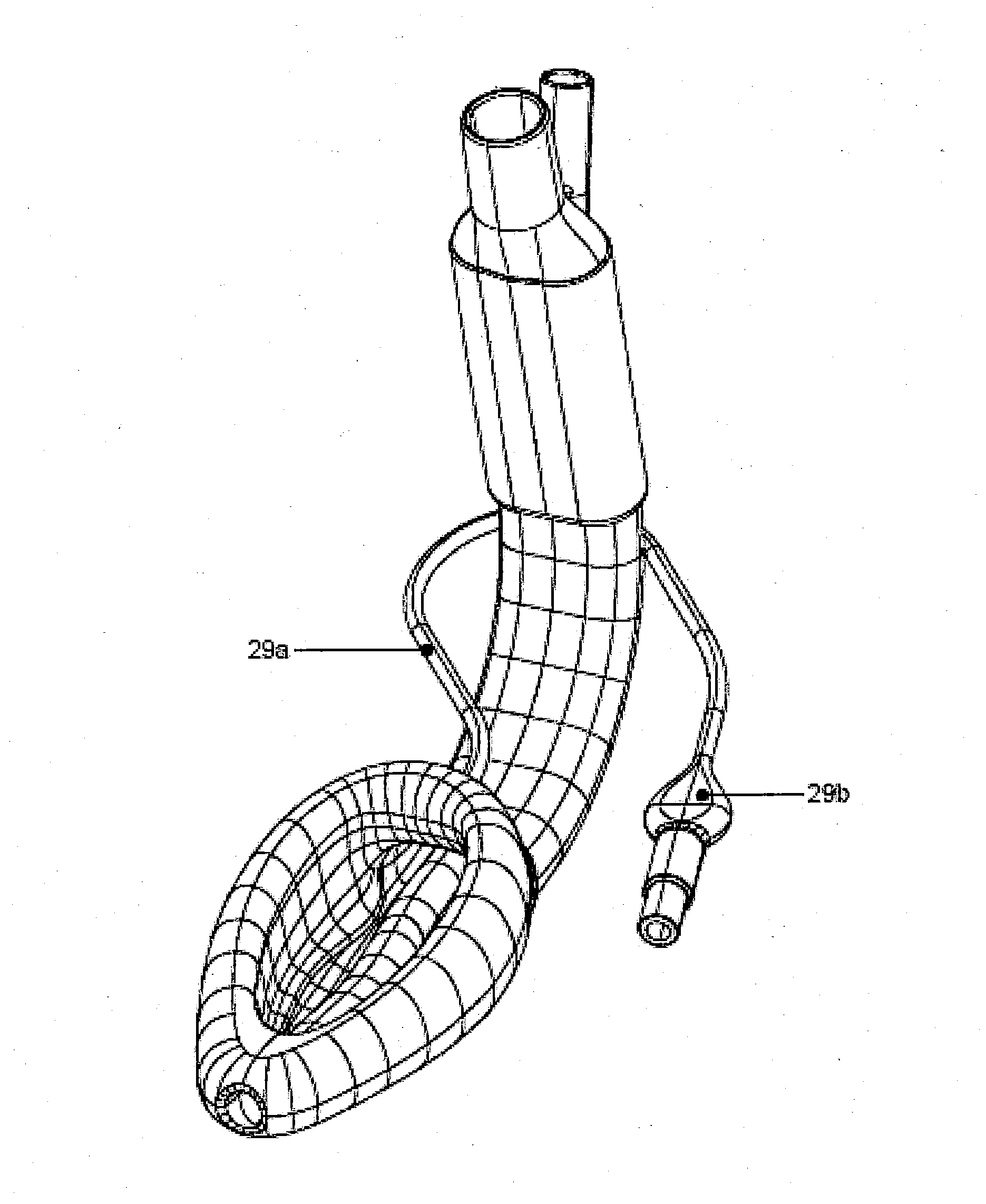 An airway management device and method of manufacture