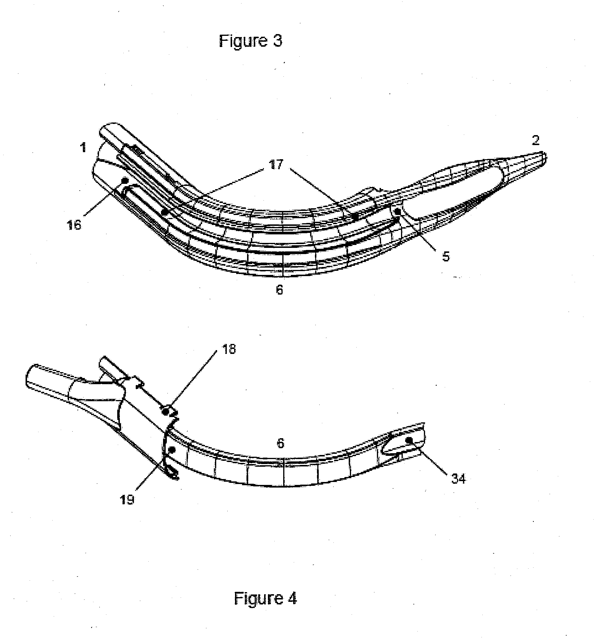 An airway management device and method of manufacture