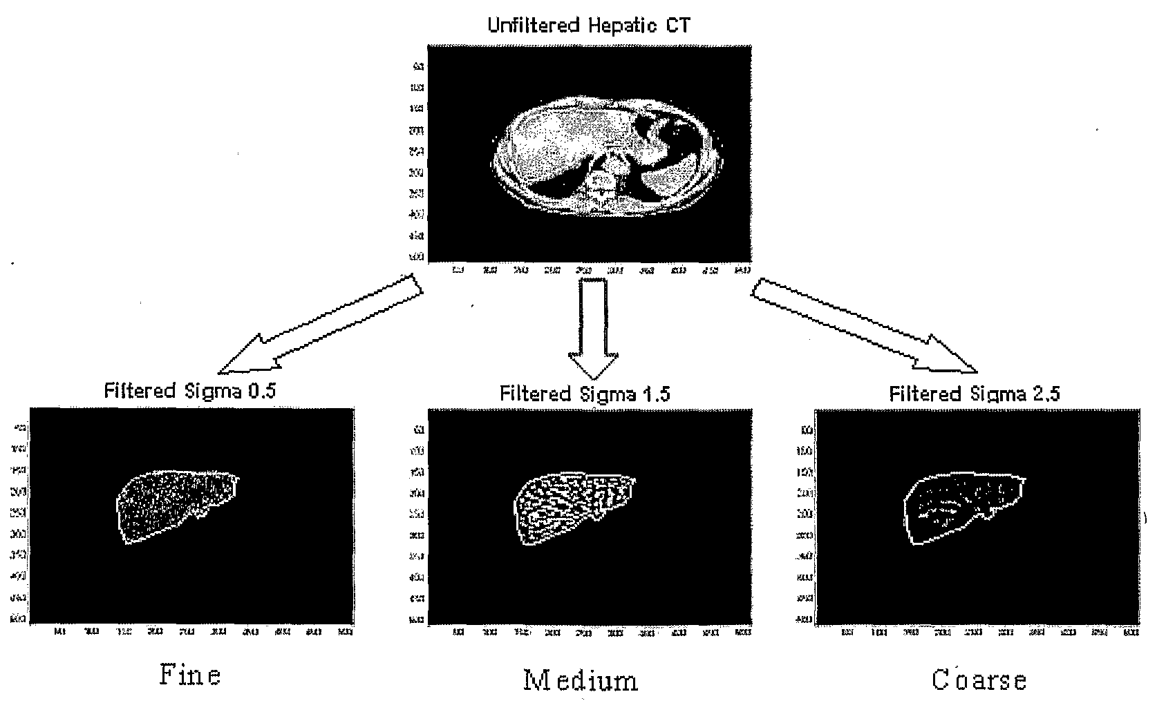 Method, apparatus and computer program for analysing medical image data