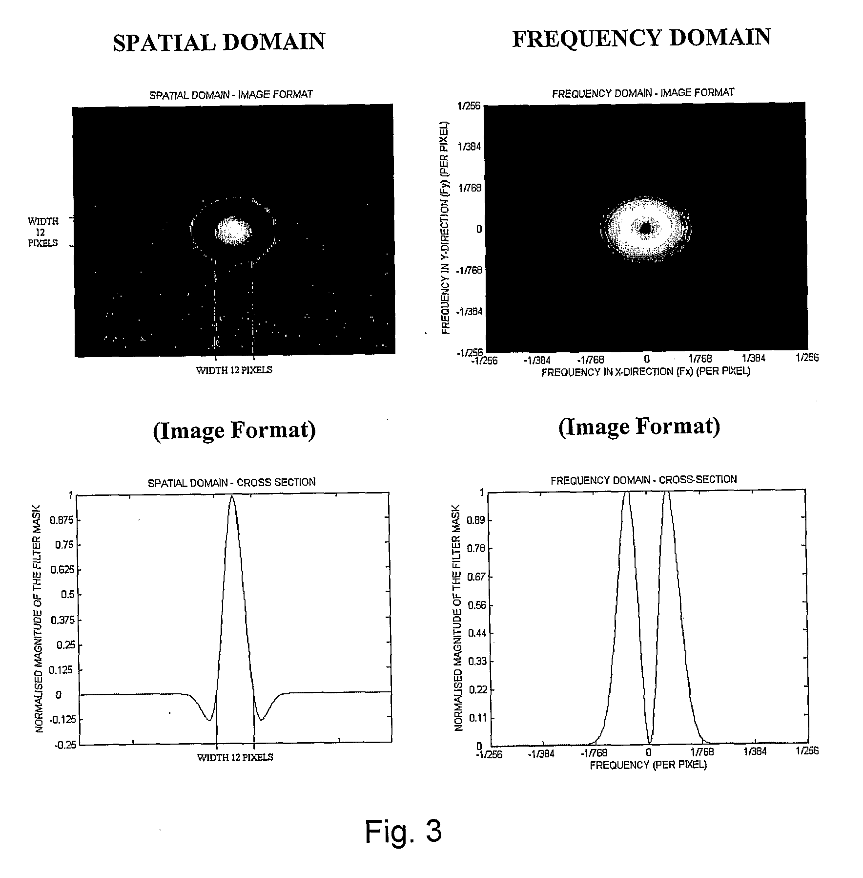 Method, apparatus and computer program for analysing medical image data